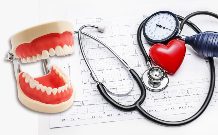 UNDERSTANDING THE RELATION BETWEEN HYPERTENSION AND ORAL DISEASES